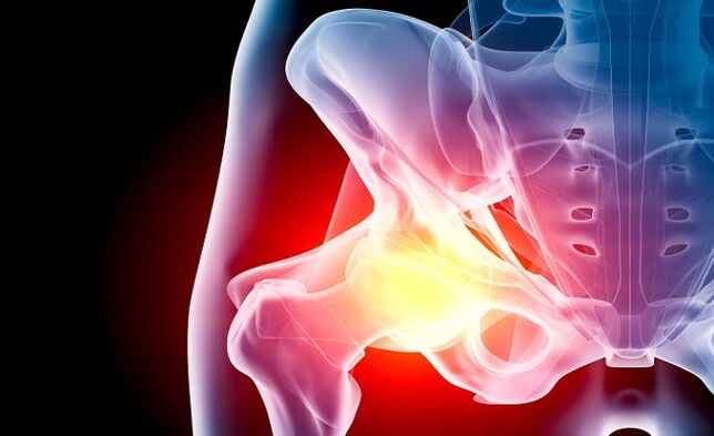 hip arthropathy