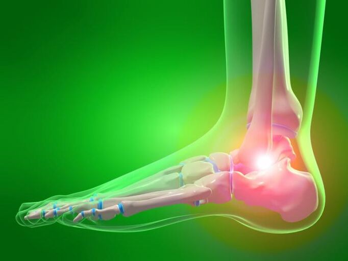 Ankle inflammation with arthropathy
