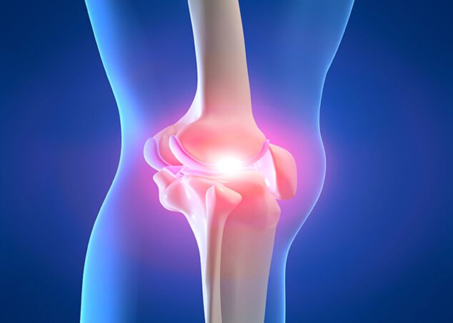 joint pain caused by knee joint