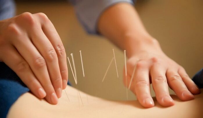 Acupuncture treats low back pain