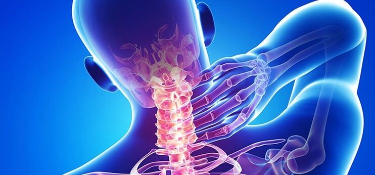 cervical osteochondrosis
