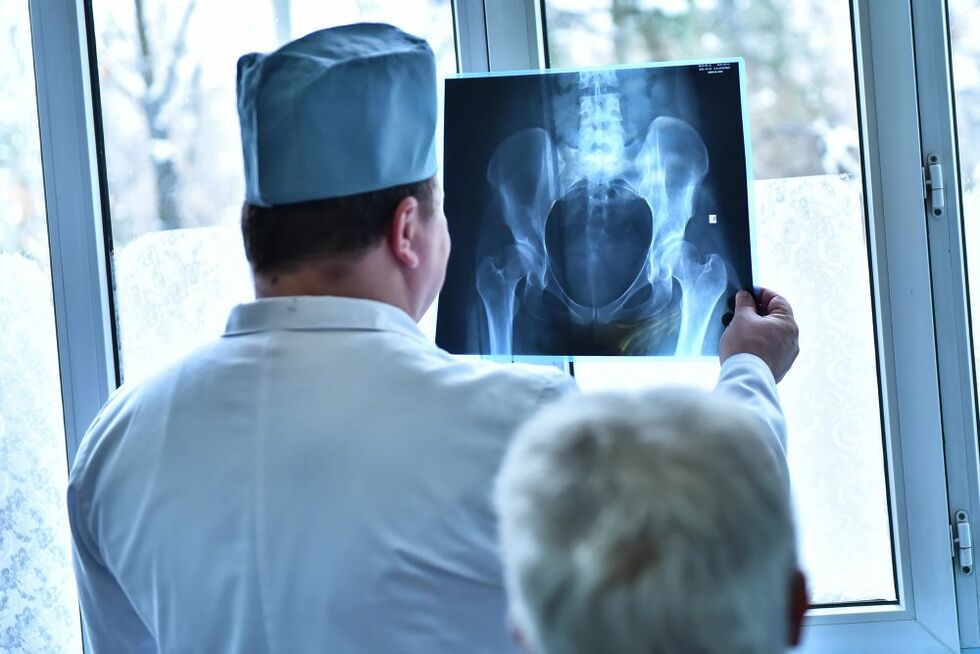 Doctor looking at a picture of an arthritic hip joint