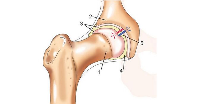 Hips and Joints