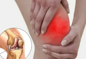 What happens when rheumatoid arthritis