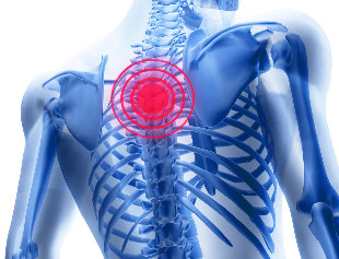 Chest pain from degenerative disc disease